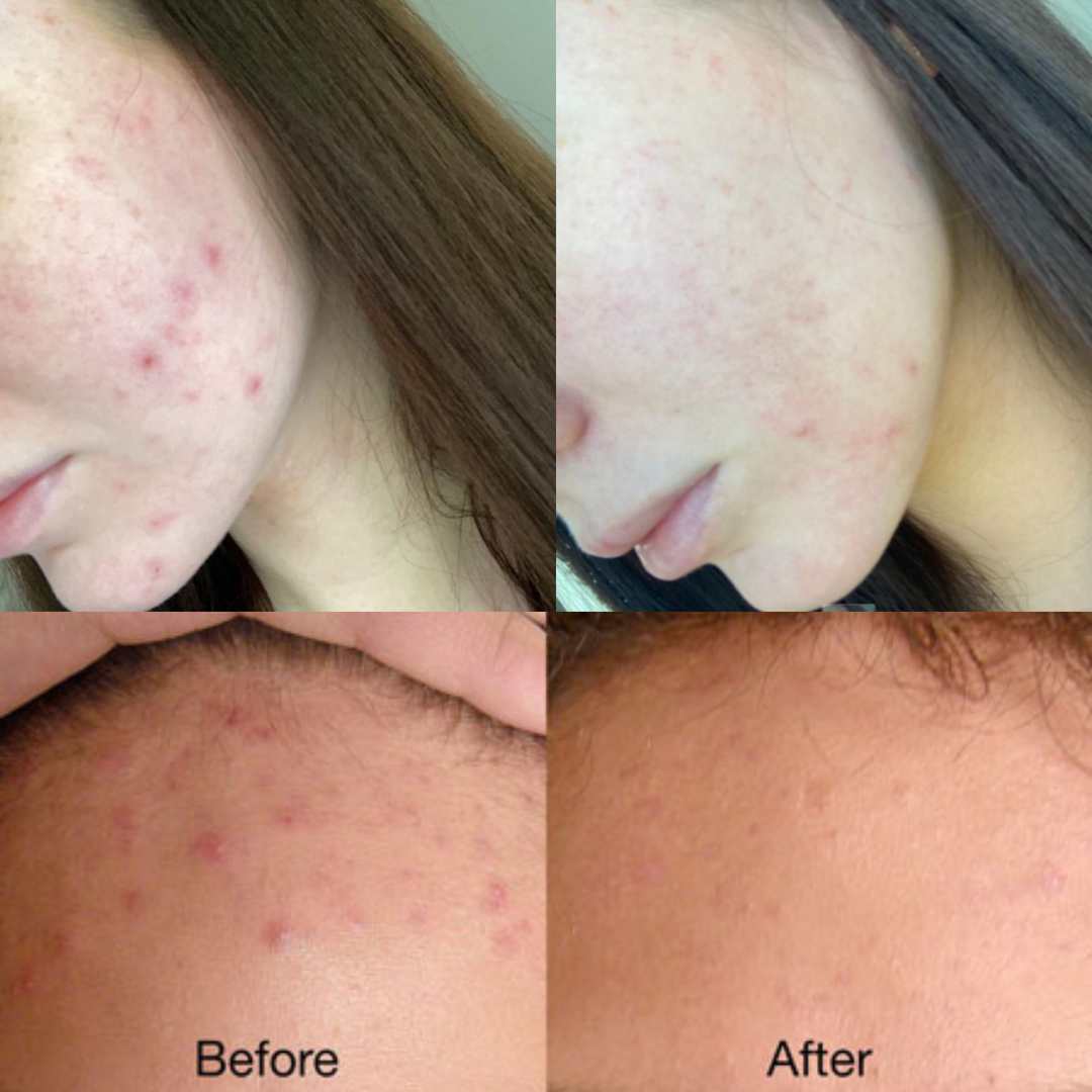 The Restorative Cream by Sky and Sol (INT)